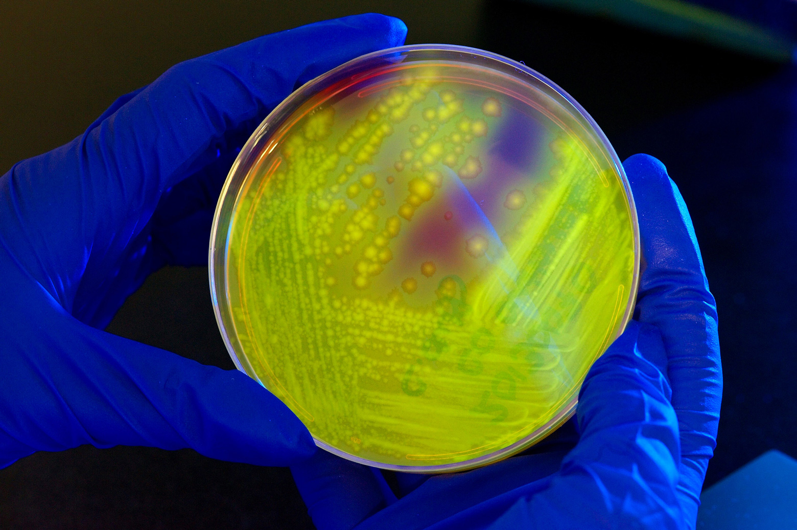 A researcher holds a petri dish containing clostridium difficile bacteria.