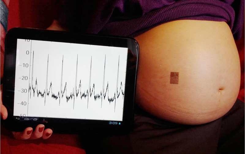 An expectant mother next to a monitoring device
