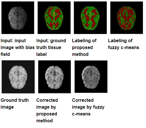 brain imaging comparison