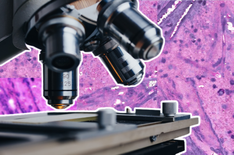 New computer vision technique enhances microscopy image analysis for improved cancer diagnosis