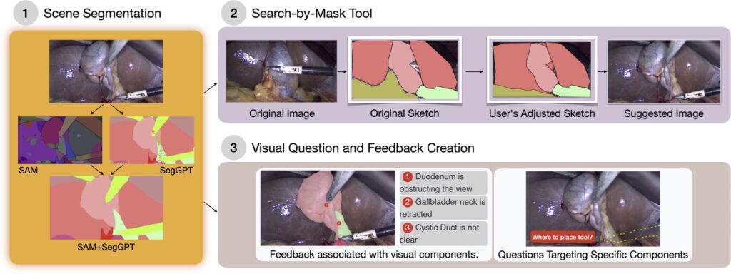 A three paneled infographic labeled: scene segmentation, search-by mask tool, and visual question and feedback creation. Scene segmentation: A gallbladder removal surgery image is then divided into editable polygons. Search-by-mask tool: The original image is modified by the user, then outputs a new image that matches the users specifications. Visual question and feedback creation: An example of dissection feedback and surgical tool placement question
