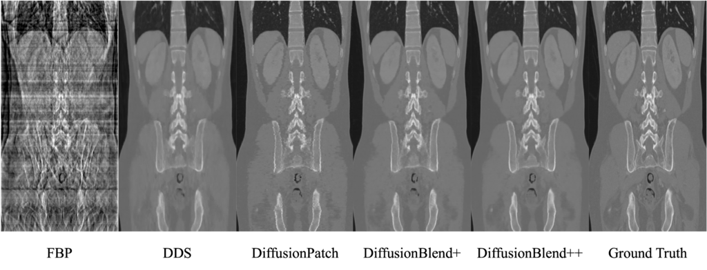 A six pane side-by-side view of CT scan reconstructions. The fourth and fifth pane, DiffusionBlend+ and DiffusionBlend++, most clearly resemble the sixth pane, ground truth.